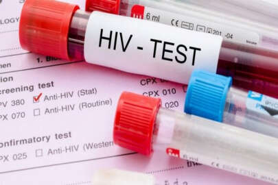 Rusya’da HIV salgını