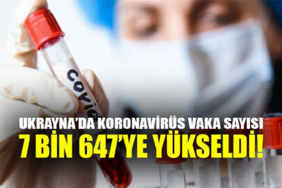 Ukrayna'da 477 yeni koronavirüs vakası tespit edildi